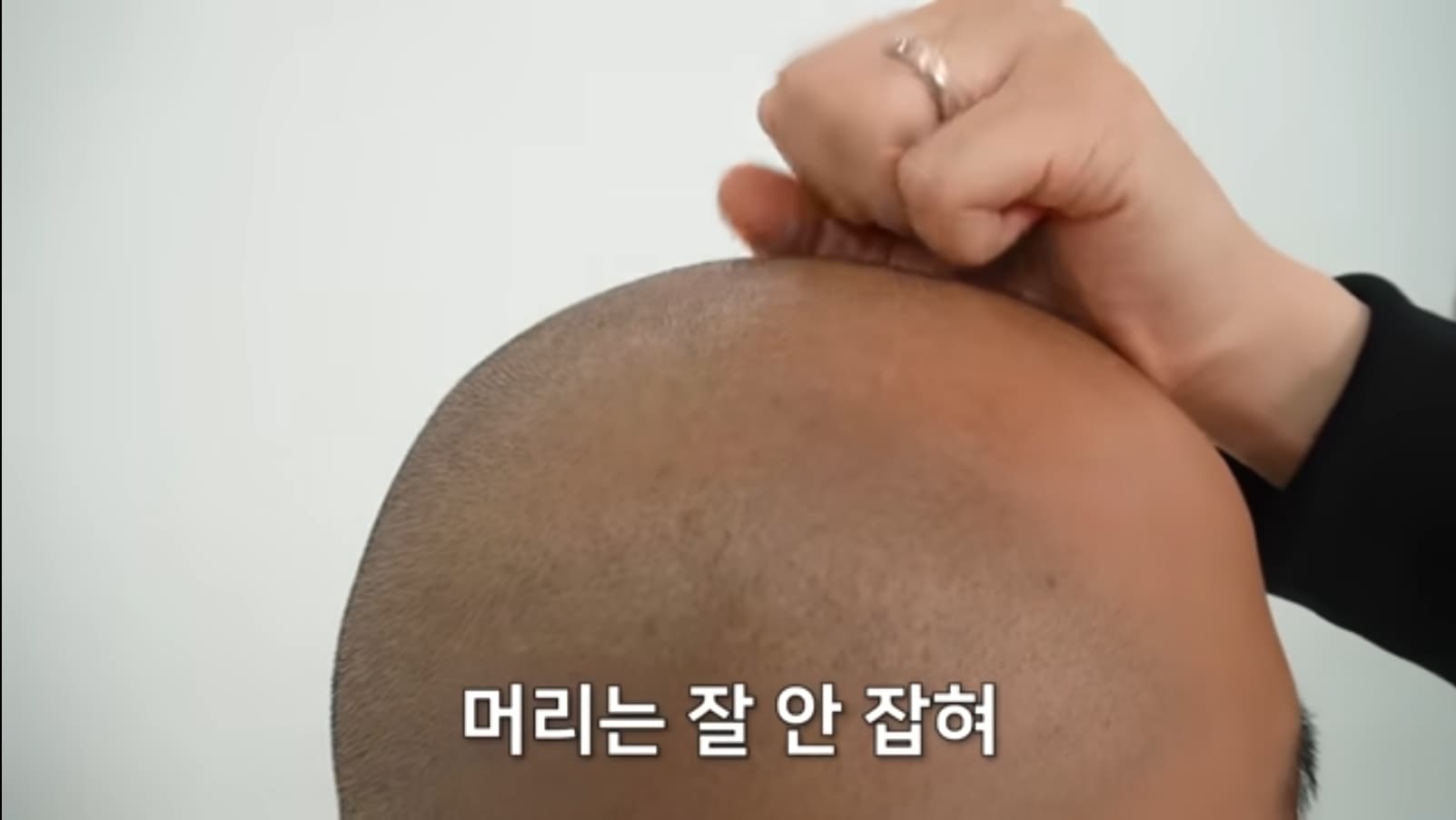 분통 터져 머리채를 쥐어잡고 싶지만 머리가 없다